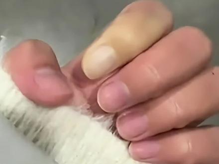 突然降温 女生的手指被冻成白色,“揉搓了近20分才缓过来”网友:像是雷诺现象,建议去医院
