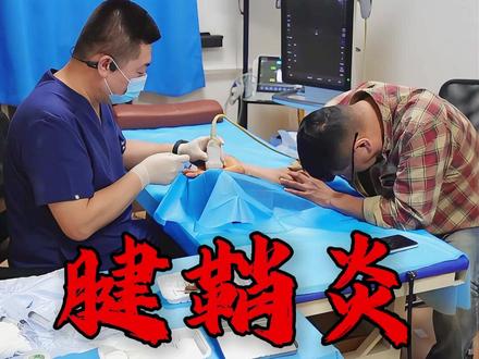 腱鞘炎 手指弯曲疼痛有卡顿#腱鞘炎 #手指疼 #医学科普