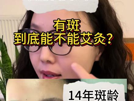 有斑可以做面部艾灸吗?#艾灸 #面部艾灸 #祛斑 #淡斑 #抗衰