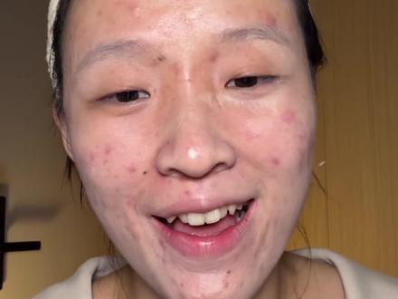 瑕疵皮的巨详细妆教!#无暇底妆#妆教#遮瑕液#油痘肌#新手化妆教程