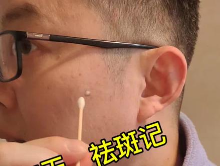 #养生 #祛斑#美容#强烈推荐