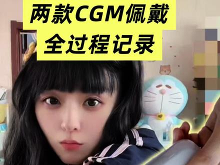 以下是我个人的佩戴体验,仅供参考,具体请遵医嘱或产品说明书~#硅基动态血糖仪 #硅基GS3 #动态血糖仪佩戴 #个人体验分享
