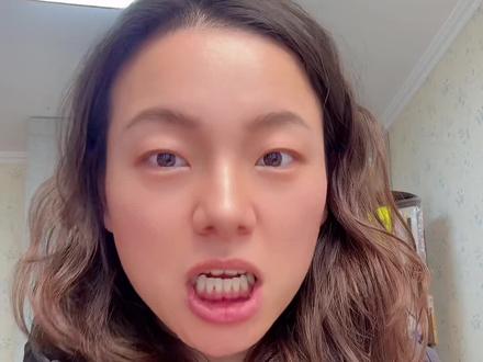 成龙大哥自曝也是名ADHD,询问大家怎样才能注意力更集中? 所以运动真的那么有效吗?
#成龙 #多动症 #adhd #注意力不集中 #懿直成长