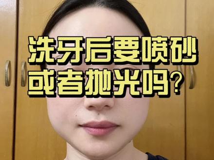 洗牙后到底要不要+喷砂和抛光呢?#健齿中国行#洗牙#口腔科普