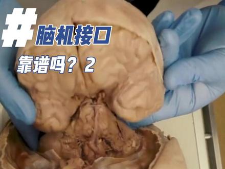 脑机接口,是怎样一种存在?2