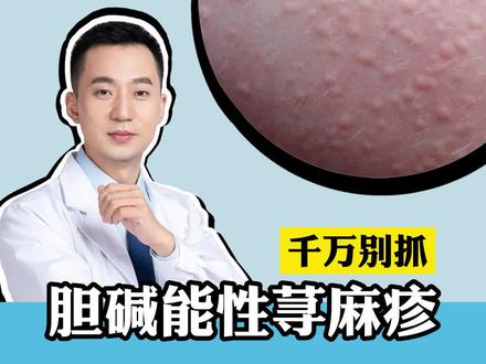 身体一热就会出现密密麻麻的小疙瘩,非常痒,别怕,这是#胆碱性荨麻疹,可以这样处理。#皮肤#科普