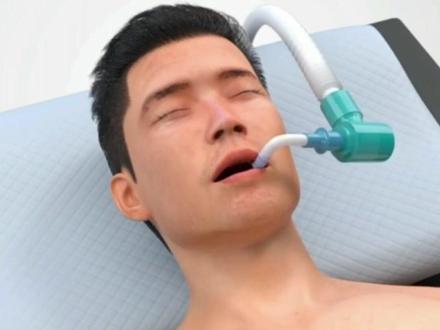 3D三孔胆囊切除手术演示#医学科普 #胆囊切除 #湖北胆石中心 #胆结石