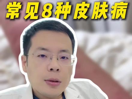 8种常见皮肤病,教你如何应对! #医学科普 #皮肤病 #涨知识 #抖出健康知识宝藏
