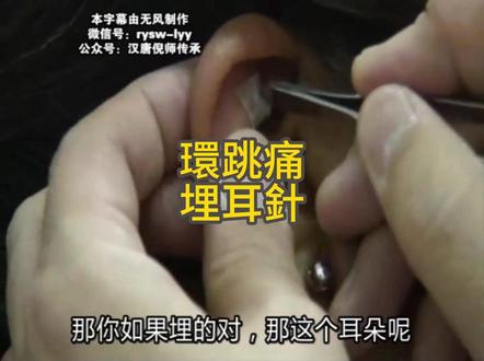 针灸大成篇 環跳痛、埋耳針(實操)#人纪倪海厦#自学中医调理身体#针灸大成