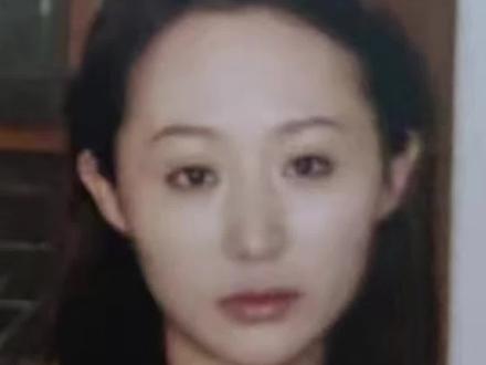 #精灵耳#招风耳 你觉得丑吗?真有人觉得好看?