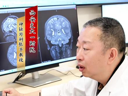 睡眠中突发癫痫#医学科普 #癫痫 #睡眠抽搐