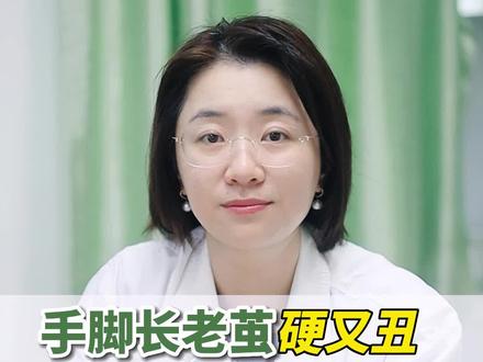 手脚上这种又黄又厚的老茧,牵个手都要被对象嫌弃!今天教你不用刀刮也可以解决的方法!#科普 #健康 #老茧 #胼胝 #医学科普