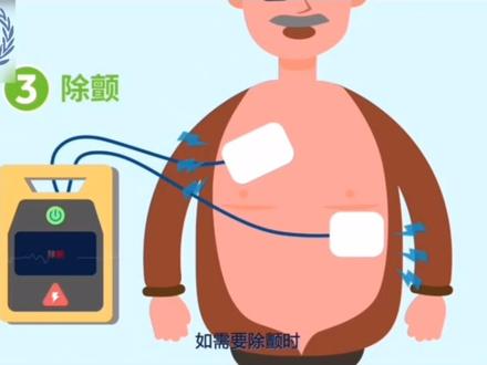 “救命神器”AED的使用方法