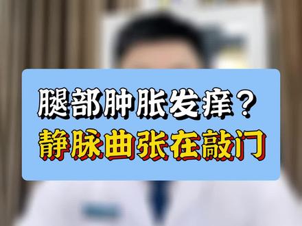 静脉曲张早期信号 #医生科普 #介入科梁茂全 #腿部肿胀 #发痒 #静脉曲张