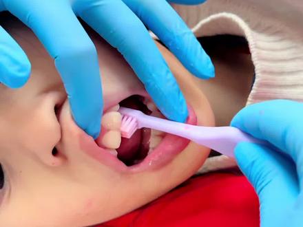 2分钟手把手教会你给孩子正确刷牙 周末也要好好刷牙哦!
#儿童口腔 #口腔健康 #正确刷牙方式 #刷牙的小朋友 #儿童牙膏