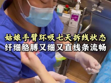 姑娘手臂环吸七天拆线状态呈现#手臂环吸 #大臂环吸 #瘦胳膊 #拜拜肉 #细胳膊细腿