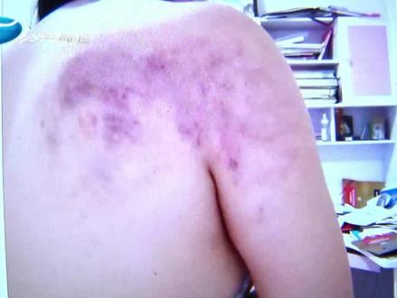 岳父病危去世 妻子没见到最后一面 竟是丈夫隐瞒消息?