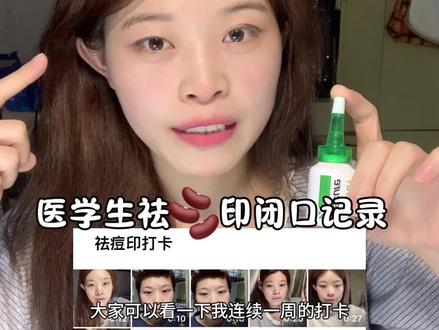 医学生祛痘印记录真实PO,小小一瓶真的巨有效!#女大学生 #拯救痘痘肌 #祛痘印 #如何淡化痘印 #闭口 @DOU+上热门 @DOU+小助手 @抖音创作小助手 @抖音小助手