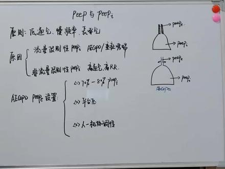 内源性PEEP(6):这部分内容很多,只跟大家简单说一下有创呼吸机的设置原则,没办法做到面面俱到。关于内源性的peep这部分内容就到此完结了!#呼吸 #呼吸机 #呼吸系统 #呼吸机