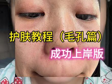护肤教程(芼孔篇) #毛孔#黑头#护肤#日常vlog#原相机