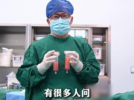 阴阜抽吸术后,能显露出来多少? #医学科普 #男科 #男性健康 #关爱男性 #抽脂