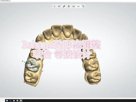 3shape牙齿模型边缘线怎么画-抖音