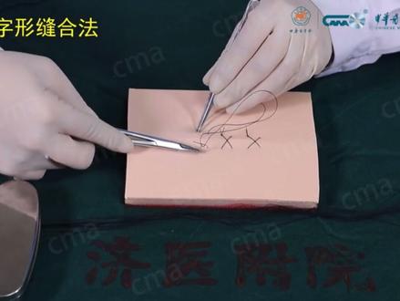 #考试 #医学生 都刷这个别刷其他的了!!!