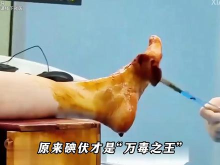 碘伏才是万毒之王?没想到碘伏的杀伤力这么强。#科普 #涨知识啦 Ψ2OZI