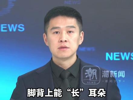 山东一女子因意外导致左耳离断,耳朵寄养脚背生长5个月后移回头上,拆线时 女子激动得热泪盈眶:“是你们给了我第二次生命”