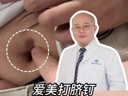 打脐钉感染导致瘢痕增生!#脐钉 #变美 #瘢痕