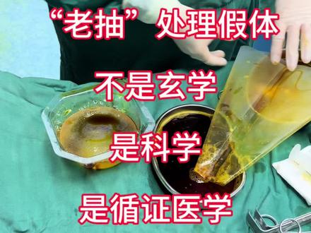 “老抽”处理胸假体
医生是不是疯了?
#胸假体 #包膜挛缩 #碘伏