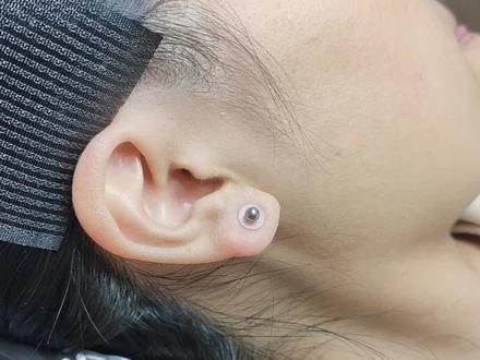 今天我们处理一个耳垂增生修复12天的样子#耳垂增生 #耳洞增生 #穿孔 #昭通手穿