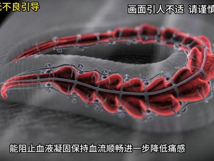 悄无声息吸血的水蛭为何让人毫无痛感 #水蛭 #动物解说 #动物科普 #动物世界 #神奇动物在抖音