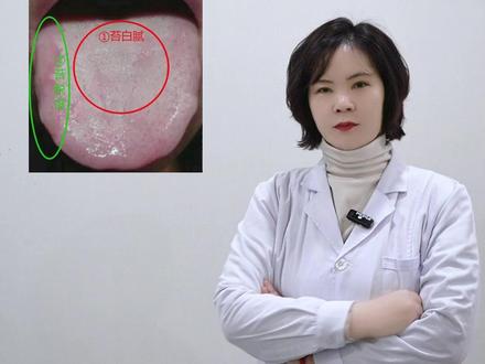 这样的舌头,不能当脾虚 #健康科普 #涨知识