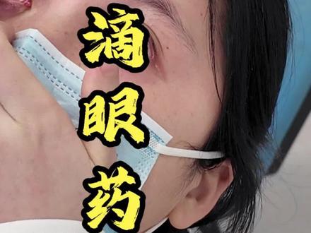 你会滴眼药水吗?有没有可能你平时的滴法都是错的#正确滴眼药水的方法 #科普一下 #抖出健康知识宝藏 #眼科医生曾雯 #保护眼睛