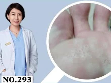 #脚臭 非常难闻,这可不一定是#脚气 #出汗 #细菌