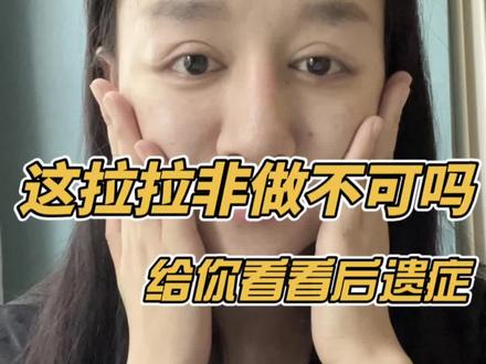 二十岁做了四五十岁的#拉皮 结果疤还没好脸就掉了!我亲身经历了 真没想的那么美好#拒绝容貌焦虑 #变美 #整容需谨慎 #整形