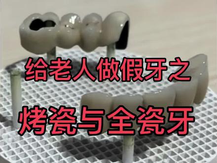 受人之约去给农村老人做假牙
#假牙#永州