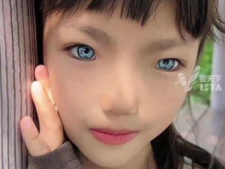 8岁女孩因患罕见病,双眼变为蓝色,妈妈:她喜欢自己独一无二的蓝眼睛