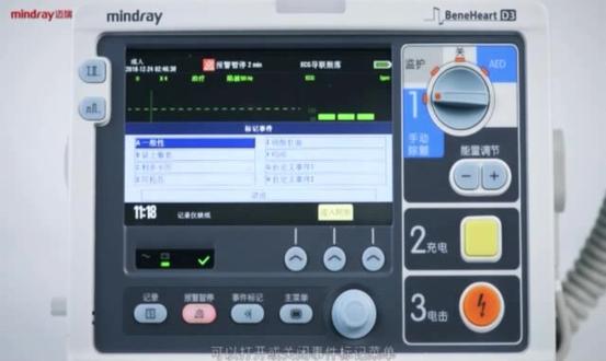 迈瑞D3除颤仪整机介绍#护士 #医生 #除颤仪 #除颤仪的使用 @抖音小助手