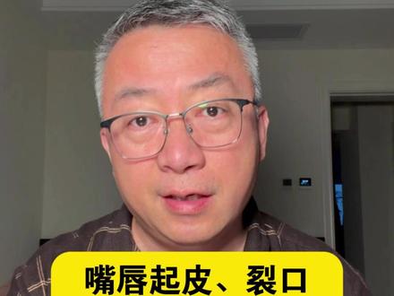 嘴唇起皮、裂口,千万不要乱撕乱舔了!#唇炎 #撕嘴皮 #抖出健康知识宝藏 #新年囤点专业货