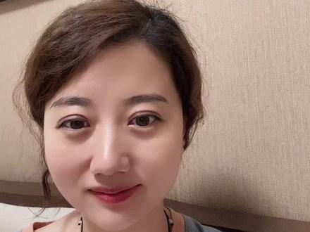 血沉、C反应蛋白