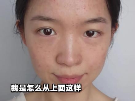 让鼻子显瘦显窄的方法!
#大鼻孔 #鼻子大 #鼻翼外扩
(内容仅供参考,效果因人而异)