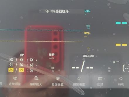 储存容量即将达到上限#原创视频 #迈瑞医疗 #监护仪 #现场实拍 #工作实拍