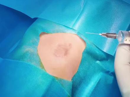 为什么有的医生打麻药不咋疼?