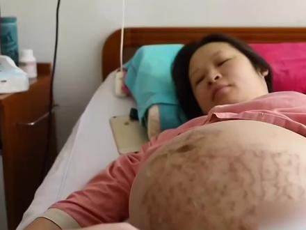 三胞胎孕妈危险重重,医生建议减胎,孕妈宁愿一命换三命