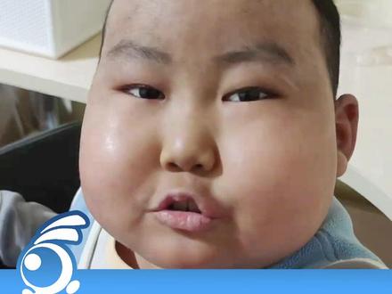 贵州白血病男孩豪豪已去世,家人:他不会再痛了(主播:@治麟不是志玲 )#百姓关注主播说