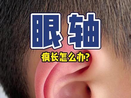 孩子近视了,眼轴长,试试这样做#耳穴#眼轴#近视#近视防控#耳穴贴的作用和功效