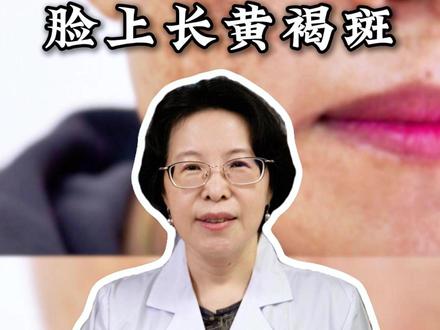 脸上长黄褐斑,消了又长,中医教你两招 #医疗健康创作训练营 #抖出健康知识宝藏 #黄褐斑 #祛斑 #中医健康科普