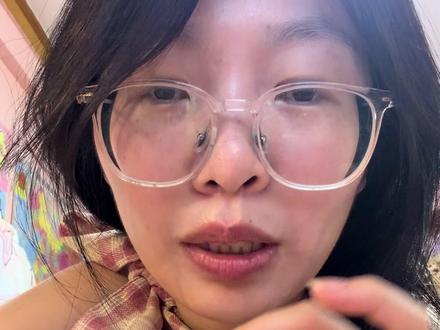 一点个人的打舌钉的经验分享(纯主观)1.如果认为不影响工作和学习自己生活,想打就去打吧不然一直惦记着
2.舌钉下面的白色物质,我喷了西瓜霜第二天就好了,不过后续还会有,有了我就喷西瓜霜感觉蛮好用的
3.吃了维生素b2和b12感觉也有用
4.嘴馋喝可乐了,感觉对恢复不利
5.辣的烫的别吃
6.第一次打一定戴上下都是球的长杆钉,大概18mm甚至20mm因为你也不知道到底能肿成啥样
7.吃饭慢点别发呆,容易咬到钉
8.我觉着比耳骨疼ꈨຶꎁꈨຶ
9.最好别抽烟
纯主观建议不适用所有人
觉得说的不对的当我没说……
#舌钉#舌钉恢复期 #经验 #记录